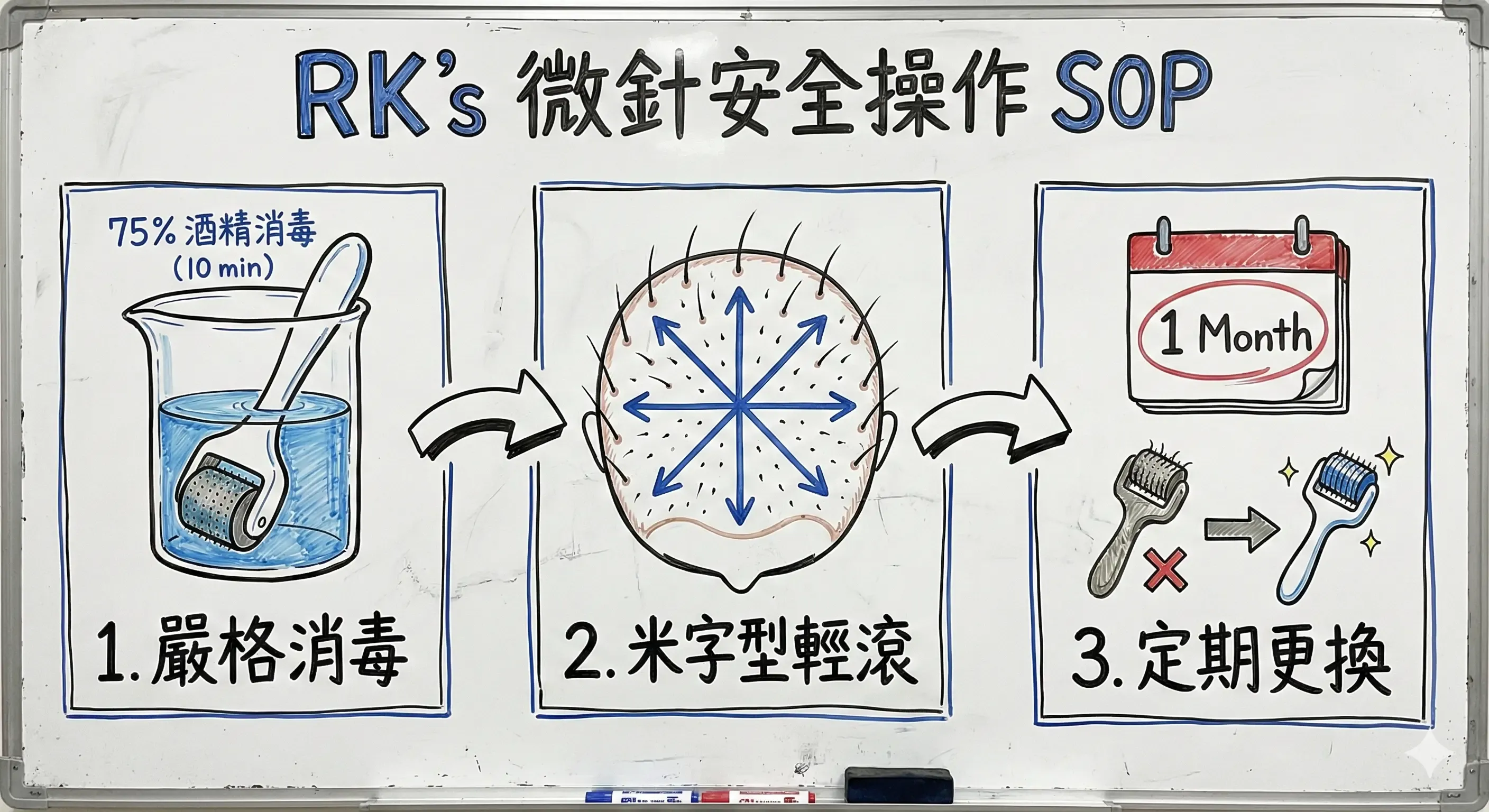 RK 的微針滾輪安全操作 SOP 手繪流程圖：第一步酒精消毒，第二步米字型輕滾，第三步定期更換滾輪
